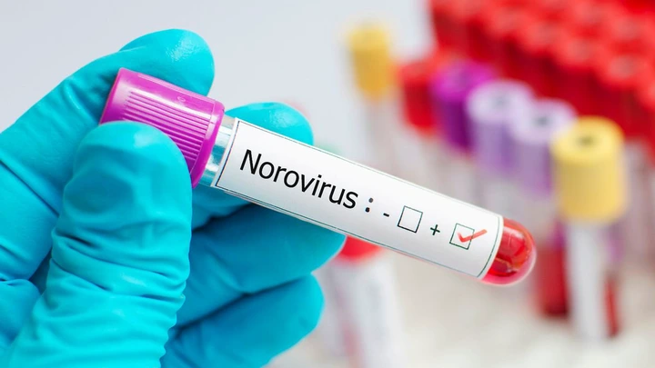 Norovirus