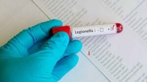 Water can become Legionella positive